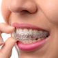 Woman smiling, putting in Invisalign clear aligners