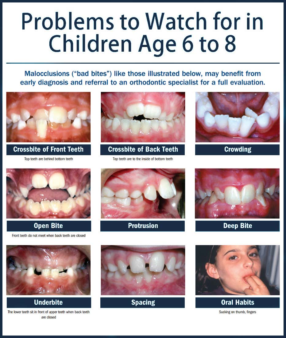 Orthodontic Treatment & Braces for Children